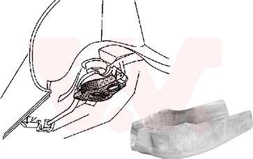 Van Wezel 3755499 - Колісна ніша autocars.com.ua